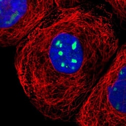 RRP1 Antibody, Novus Biologicals 0.1mL; Unlabeled:Antibodies, Polyclonal
